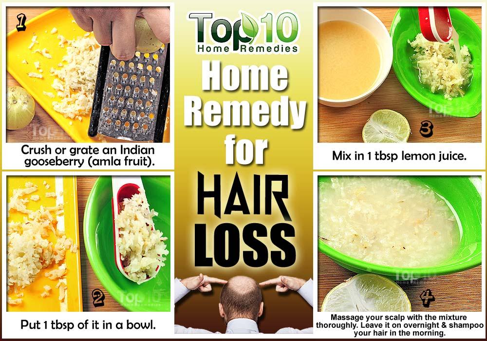 Home Remedies For Hair Loss | This Big Buzz